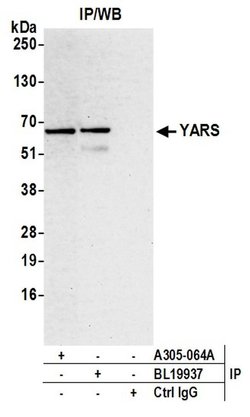 YARS/Tyrosyl-tRNA Synthetase/TYRRS Rabbit anti-Human, Mouse, Polyclonal,