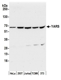 YARS/Tyrosyl-tRNA Synthetase/TYRRS Rabbit anti-Human, Mouse, Polyclonal,