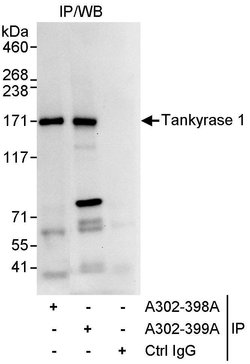 Tankyrase 1 Rabbit anti-Human, Polyclonal, Bethyl Laboratories 100 &mu;L;