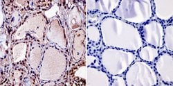 Invitrogen THRB Monoclonal Antibody (J52) 100 &mu;L; Unconjugated:Antibodies,