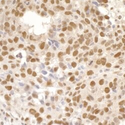 Timeless Rabbit anti-Human, Polyclonal, Bethyl Laboratories 100 &mu;L;