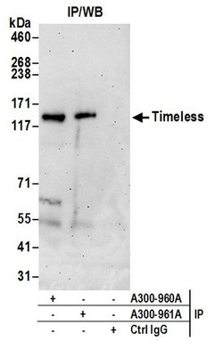 Timeless Rabbit anti-Human, Polyclonal, Bethyl Laboratories 10 &mu;L; Unconjugated:Antibodies,