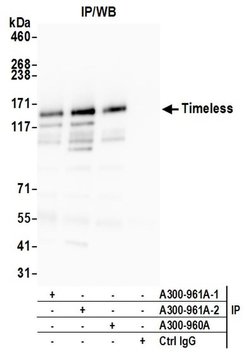 Timeless Rabbit anti-Human, Polyclonal, Bethyl Laboratories 100 &mu;L;