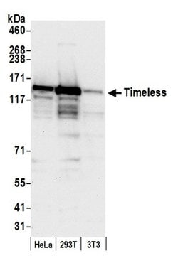 Timeless Polyclonal Antibody, Bethyl Laboratories:Antibodies:Primary Antibodies