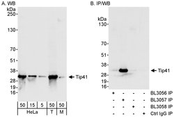Tip41 Rabbit anti-Human, Mouse, Polyclonal, Bethyl Laboratories 100 &mu;L;