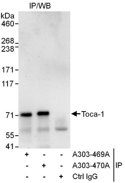 Toca-1 Rabbit anti-Human, Polyclonal, Bethyl Laboratories 100 &mu;l; Unlabeled:Antibodies,