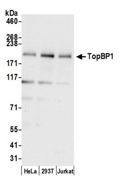 TopBP1 Rabbit anti-Human, Mouse, Polyclonal, Bethyl Laboratories 100 &mu;l;