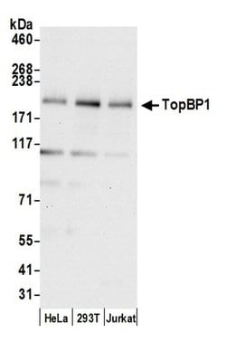 TopBP1 Polyclonal Antibody, Bethyl Laboratories 20 &mu;L; Unconjugated:Antibodies,