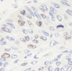 Topo II Alpha Polyclonal Antibody, Bethyl Laboratories:Antibodies:Primary