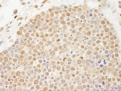 Topo II Beta Rabbit anti-Human, Polyclonal, Bethyl Laboratories 100 &mu;L;