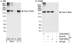 Topo II Beta Rabbit anti-Human, Polyclonal, Bethyl Laboratories 100 &mu;L;