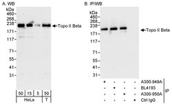 Topo II Beta Rabbit anti-Human, Polyclonal, Bethyl Laboratories 100 &mu;L;