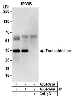 Transaldolase Rabbit anti-Human, Mouse, Polyclonal, Bethyl Laboratories