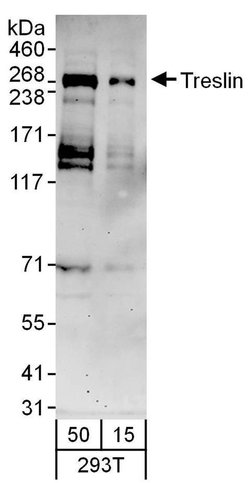 Treslin Rabbit anti-Human, Polyclonal, Bethyl Laboratories 100 &mu;L; Unconjugated:Antibodies,
