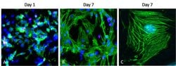 Invitrogen™ Cardiac Troponin T Monoclonal Antibody (13-11)