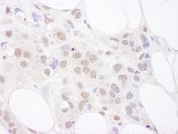 U2AF65 Rabbit anti-Human, Polyclonal, Bethyl Laboratories 100 &mu;L; Unconjugated:Antibodies,