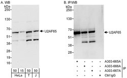 U2AF65 Rabbit anti-Human, Polyclonal, Bethyl Laboratories 100 &mu;L; Unconjugated:Antibodies,