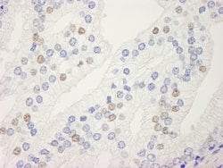 UACA Rabbit anti-Human, Polyclonal, Bethyl Laboratories 10 &mu;L; Unconjugated:Antibodies,