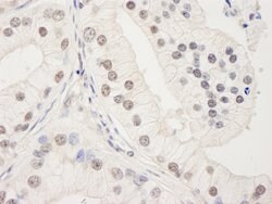 UACA Rabbit anti-Human, Polyclonal, Bethyl Laboratories 10 &mu;L; Unconjugated:Antibodies,