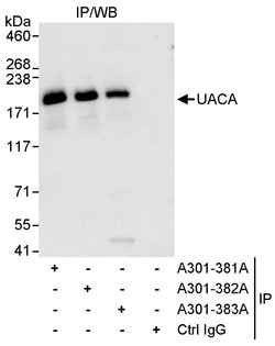 UACA Rabbit anti-Human, Polyclonal, Bethyl Laboratories 10 &mu;L; Unconjugated:Antibodies,