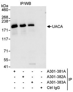 UACA Rabbit anti-Human, Polyclonal, Bethyl Laboratories 10 &mu;L; Unconjugated:Antibodies,