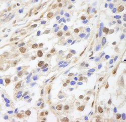 UACA Polyclonal Antibody, Bethyl Laboratories 100 &mu;l; Unlabeled:Antibodies,