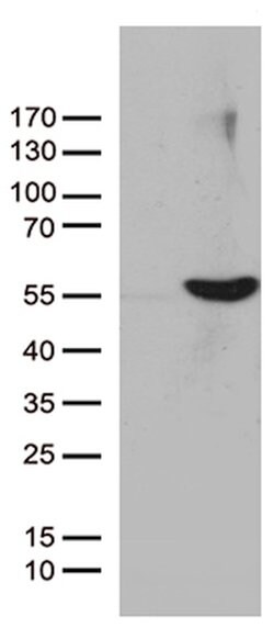 UBA3 Mouse anti-Canine, Human, Mouse, Rat, Clone: OTI1B10, lyophilized,