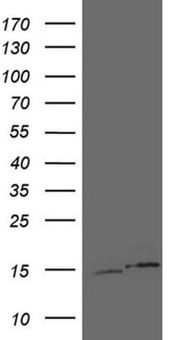 UBA52 Monoclonal Antibody (OTI4E1), TrueMAB , OriGene 100 &mu;L; Unconjugated:Antibodies,