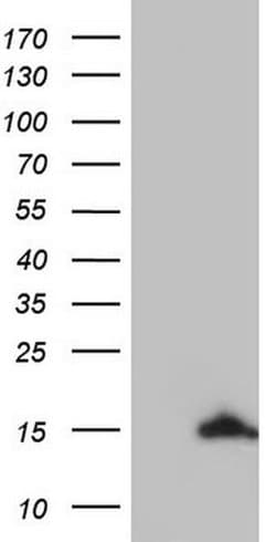 UBA52 Monoclonal Antibody (OTI5E3), TrueMAB , OriGene:Antibodies:Primary