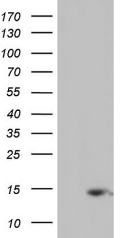 UBA52 Mouse anti-Human, Clone: OTI7A8, lyophilized, TrueMAB 100 &mu;g;