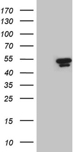 UBAC1 Mouse anti-Human, Clone: OTI6D6, lyophilized, TrueMAB 100 &mu;g;