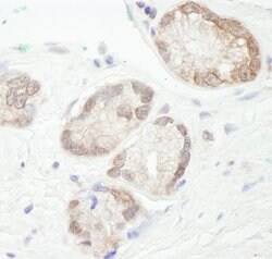 UBCH7 Rabbit anti-Human, Mouse, Polyclonal, Bethyl Laboratories 100 &mu;l;