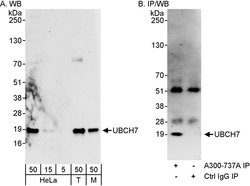 UBCH7 Rabbit anti-Human, Mouse, Polyclonal, Bethyl Laboratories 100 &mu;l;