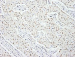 UBE1 Polyclonal Antibody, Bethyl Laboratories:Antibodies:Primary Antibodies