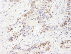 UBE1 Polyclonal Antibody, Bethyl Laboratories 100 &mu;L; Unconjugated:Antibodies,