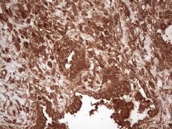 UBE2D2 Monoclonal Antibody (OTI1D11), TrueMAB , OriGene 100 &mu;L; Unconjugated:Antibodies,