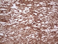 UBE2D2 Monoclonal Antibody (OTI1D11), TrueMAB , OriGene 100 &mu;L; Unconjugated:Antibodies,