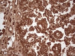 UBE2D2 Monoclonal Antibody (OTI1D11), TrueMAB , OriGene 100 &mu;L; Unconjugated:Antibodies,