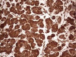 UBE2D2 Monoclonal Antibody (OTI1D11), TrueMAB , OriGene 100 &mu;L; Unconjugated:Antibodies,
