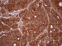 UBE2D2 Monoclonal Antibody (OTI1D11), TrueMAB , OriGene 100 &mu;L; Unconjugated:Antibodies,
