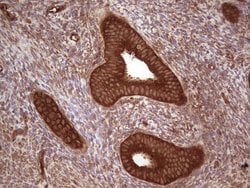 UBE2D2 Monoclonal Antibody (OTI1D11), TrueMAB , OriGene 100 &mu;L; Unconjugated:Antibodies,