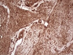 UBE2D2 Monoclonal Antibody (OTI1D11), TrueMAB , OriGene 100 &mu;L; Unconjugated:Antibodies,