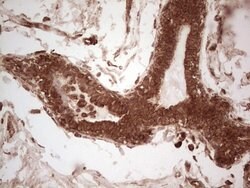 UBE2D2 Monoclonal Antibody (OTI1D11), TrueMAB , OriGene 100 &mu;L; Unconjugated:Antibodies,