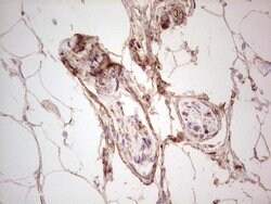 UBE2D2 Monoclonal Antibody (OTI1D11), TrueMAB , OriGene 100 &mu;L; Unconjugated:Antibodies,