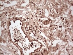 UBE2D2 Monoclonal Antibody (OTI1D11), TrueMAB , OriGene 100 &mu;L; Unconjugated:Antibodies,