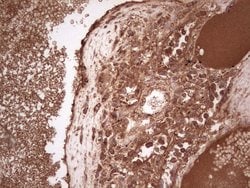 UBE2D2 Monoclonal Antibody (OTI1D11), TrueMAB , OriGene 100 &mu;L; Unconjugated:Antibodies,
