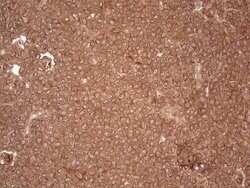 UBE2D2 Monoclonal Antibody (OTI1D11), TrueMAB , OriGene 100 &mu;L; Unconjugated:Antibodies,