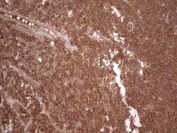 UBE2D2 Monoclonal Antibody (OTI1D11), TrueMAB , OriGene 100 &mu;L; Unconjugated:Antibodies,