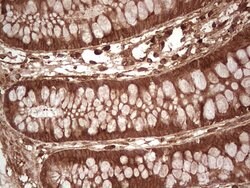 UBE2D2 Monoclonal Antibody (OTI1D11), TrueMAB , OriGene 100 &mu;L; Unconjugated:Antibodies,