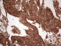 UBE2D2 Monoclonal Antibody (OTI1D11), TrueMAB , OriGene 100 &mu;L; Unconjugated:Antibodies,